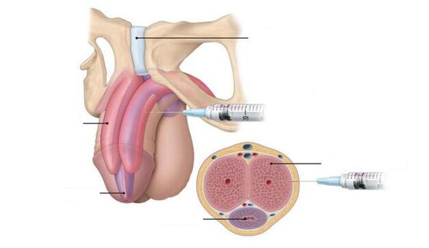 injection to improve potency